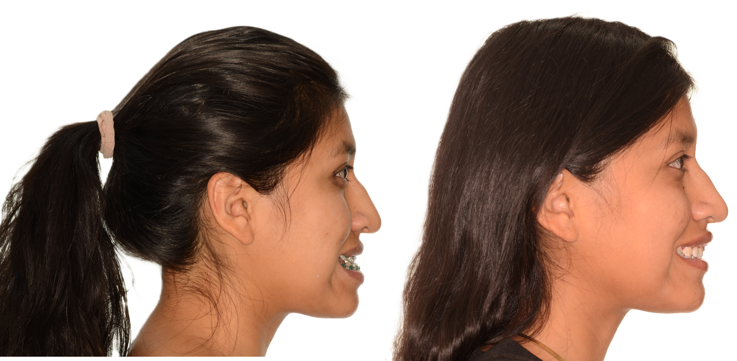 Perfil Sonrisa