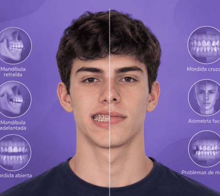 ¿Qué problemas corrige la cirugía ortognática?